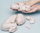 Fetus Set